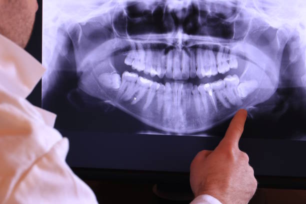 Best Dental Abscess Treatment in Penn State Erie, PA